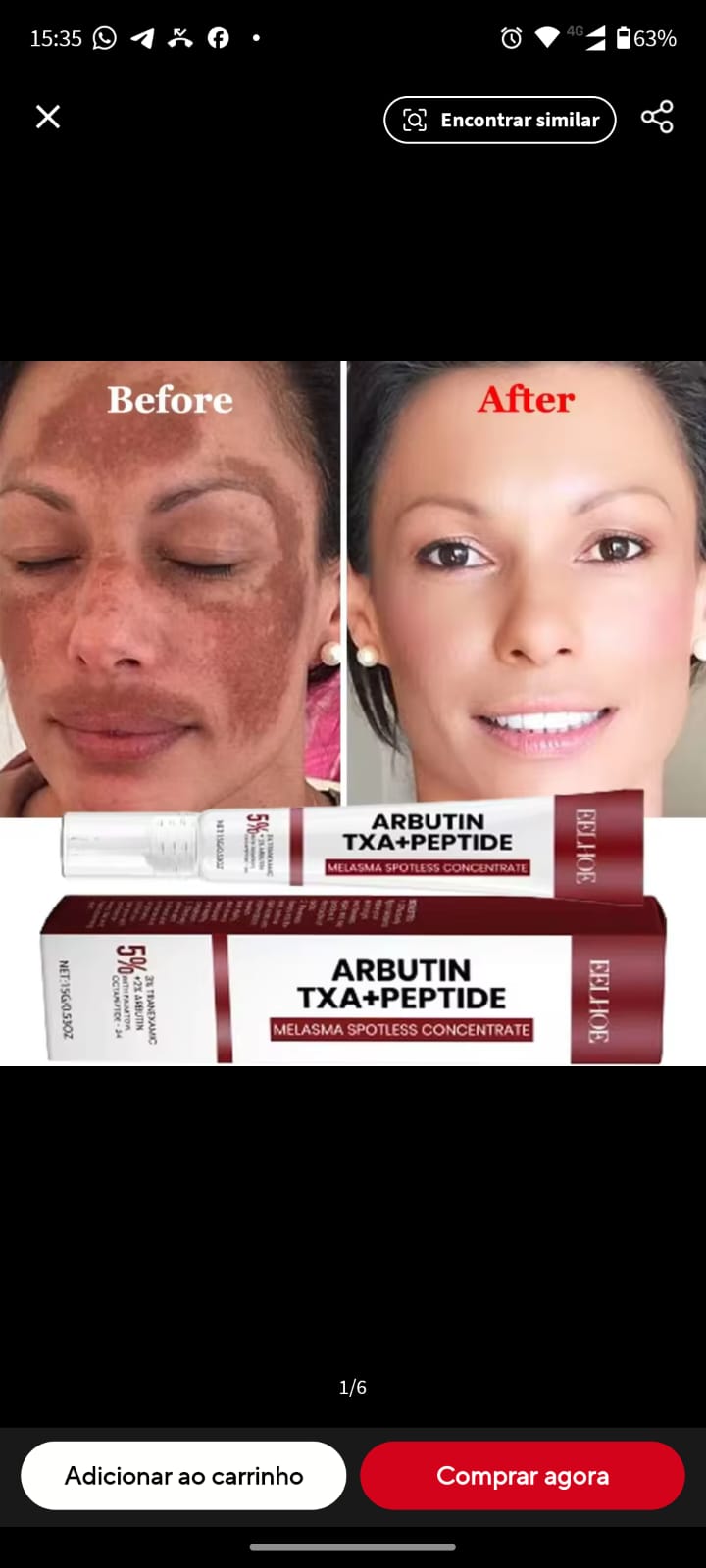 arbutin